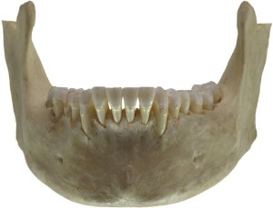 Human_jawbone_front
