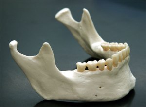 Mandible_11_a
