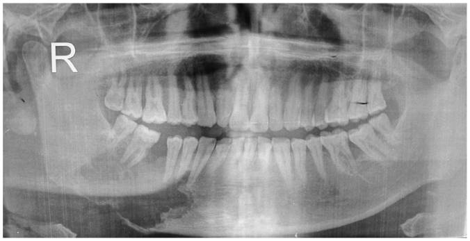 pathologicaljaw
